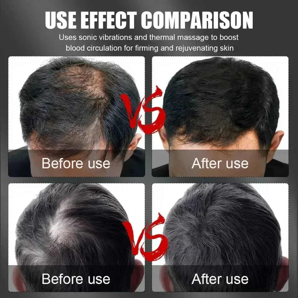 Infrared Light Hair Therapy Cap