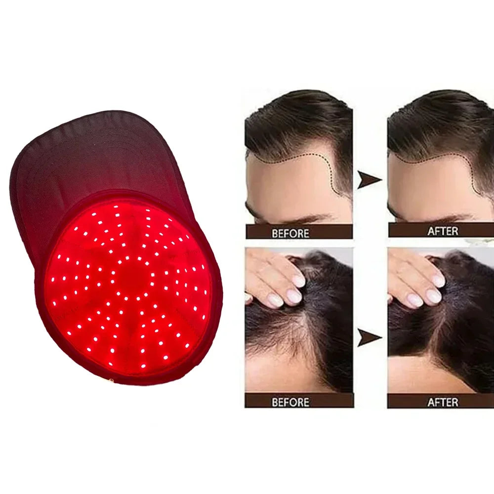 Infrared Light Hair Therapy Cap